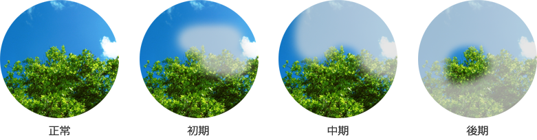 【眼圧管理】((；ﾟДﾟ)緑内障ｽﾚpart33【視野保存】 [無断転載禁止]©2ch.net ->画像>8枚 